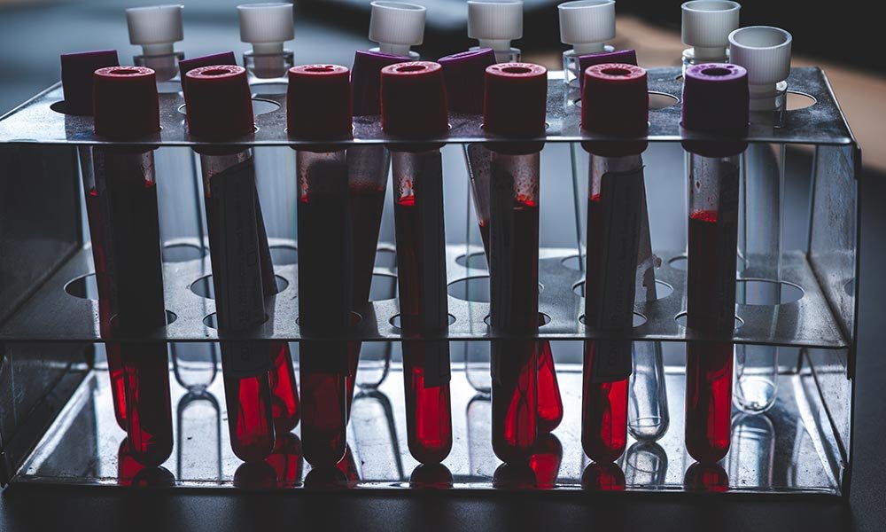 Several vials of blood for testing
